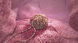 360° Tumor Death Animation demo [upl. by Nas]