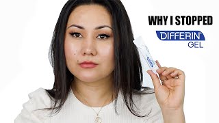 WHY I STOPPED USING DIFFERIN GEL  ADAPALENE GEL 01 ACNE TREATMENT  Zulayla [upl. by Edmead922]