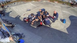 DAD BREAKS HIS LEG IN TWO PLACES AT SKATE PARK WITH FOUR KIDS [upl. by Kerrison]