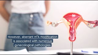 Contributions of m⁶A RNA modification to gynecological health and disease [upl. by Orton]