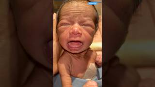 Infected Eyemedical newbornbaby doctor viralvideo [upl. by Keiko]