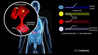 4 Effects of Hyperglycemia 1 [upl. by Christmann]