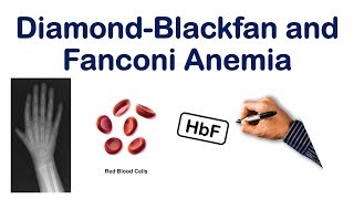 Diamond Blackfan and Fanconi Anemia Mnemonic  USMLE STEP NCLEX COMLEX [upl. by Asilef]