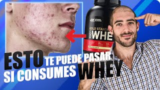 🥛 LÁCTEOS y Proteína de SUERO Whey Protein🥛 ¿Producen ACNÉ 👹 ¿Mejor la leche entera o la semi 🙀 [upl. by Rednaeel]