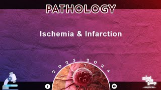 Revision of L15 part1 Ischemia and Infarction Pathology [upl. by Tempest]