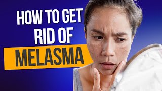 How to get rid of melasma [upl. by Siroled51]