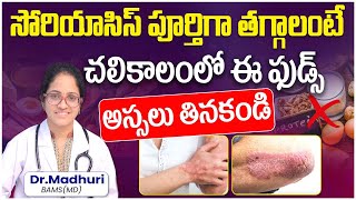 Food to Avoid For Psoriasis Patients in Telugu  Psoriasis Food Diet  Skin Infection Treatment [upl. by Zaraf]