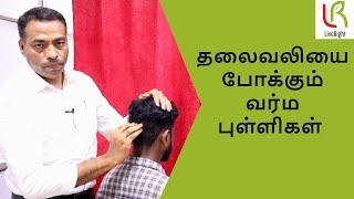 தலைவலியை போக்கும் வர்ம புள்ளிகள்  Varma Kalai  DrMathivanan  LiveRight Ayurveda [upl. by Silohcin235]