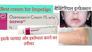 Ozenoxacin cream review Benefits  How to use amp side effects  Best cream for Impetigo  Skin inf [upl. by Noak407]