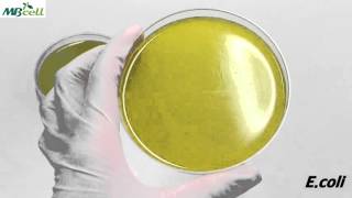 Bacillus Cereus Agar [upl. by Lorimer968]