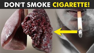 how cigarette smoke damage lungs [upl. by Eglantine178]