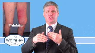 Phlebitis  What is phlebitis and how should phlebitis be treated [upl. by Eldoree]