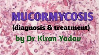 Microbiology lectures Mucormycosis diagnosis amp treatmentMycology [upl. by Drabeck]