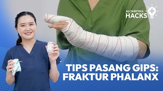 Tips Pasang GIPS Fraktur Phalanx [upl. by Racklin]