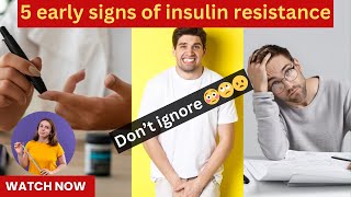 Early signs of insulin resistance  Symptoms of insulin resistance  Early signs of diabetes [upl. by Dorelia]