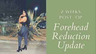 FOREHEAD REDUCTION2 WEEK POSTOP UPDATE [upl. by Ilojna]