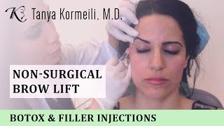 Nonsurgical Brow Lift [upl. by Delano746]