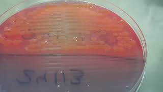 Colony characteristics of Citrobacter freundii on CLED Agar of Urine Culture [upl. by Cyndie115]