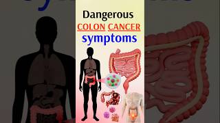 Cancer Symptoms You Should NEVER Ignore [upl. by Zackariah]