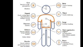 Mystery diagnosis Cystinosis [upl. by Astor936]