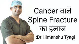 Cancer वाले Spine Fracture का इलाज Pathological spine fracture treatment [upl. by Aikim]