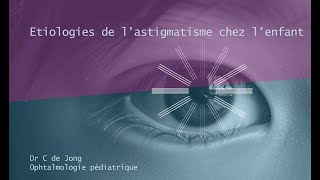 Etiologies de lastigmatisme chez lenfant [upl. by Anerok520]