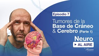 Tumores de la Base de Cráneo Parte 1 NEURO AL AIRE Episodio 7 [upl. by Browne]