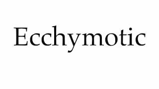 How to Pronounce Ecchymotic [upl. by Nalyk]