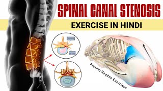 Spinal canal stenosis exercises in hindi  6 best lumbar canal stenosis exercises in hindi [upl. by Nedi906]