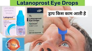 Latanoprost Eye Drops use Side effects  Latoprost eye drops  Glucoma drops [upl. by Naeruat]