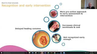 Smith  Nephew Sponsored Learning A Route to More Effective Chronic Wound Management [upl. by Otilesoj]