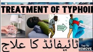 treatment of typhoid [upl. by Youngman]