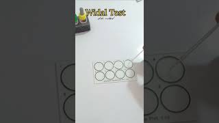 Widal test slide method shortvideo shotfeed viralshort [upl. by Zarger]