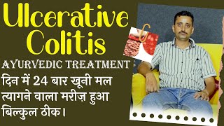 Ulcerative Colitis Ayurvedic Treatment दिन में 24 बार खूनी मल त्यागने वाला मरीज़ हुआ बिल्कुल ठीक। [upl. by Noterb776]