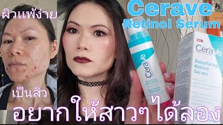 รีวิว  Cerave Retinol Serum ผิวแพ้ง่าย  ผิวเป็นสิว  รอยดำรวยแดงจากสิว 👍🥰 [upl. by Ames347]