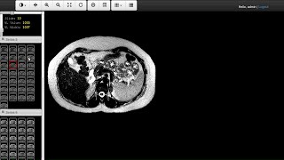 Web DICOM Viewer [upl. by Otis]