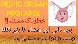 What is Pelvic Organ Prolapse  Symptoms and treatment Part 1  UrduHindi [upl. by Naegem]