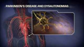 Neurogenic Orthostatic Hypotension  Medical Animation [upl. by Hetty]