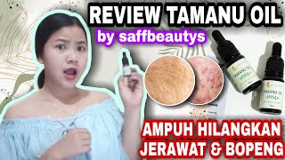 HATI HATI PEMAKAIAN TAMANU OIL  REVIEW TAMANU OIL by saffbeautys [upl. by Repsihw]