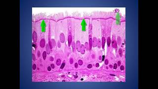 EPITELIO PSEUDOESTRATIFICADO CILIADO CON CELULAS CALICIFORMES [upl. by Aiek]