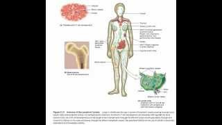 الحمى المالطية brucellosis  brucella [upl. by Estella916]