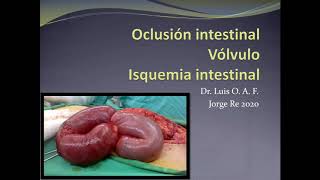 OBSTRUCCION INTESTINAL [upl. by Cheshire]