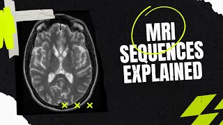 MRI sequences How to identify  the easy way For medical students residents clinicians [upl. by Boycey]