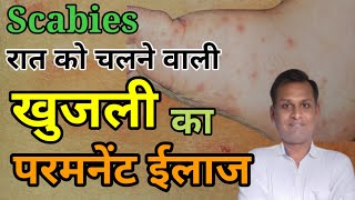 Scabies  Khujli  Itching खुजली का ईलाज [upl. by Ahsiema]