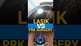 Lasik Vs PRK Surgery for Specs Removal [upl. by Boyse]