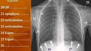 radioanatomie du thorax 2 Questions [upl. by Wieche883]