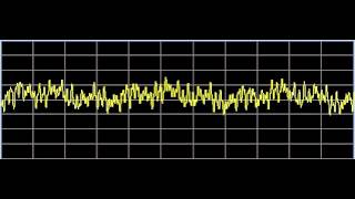 Inflammation  Rife Frequencies [upl. by Zinah685]