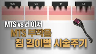 MTS 침길이별 효과 or 부작용  MTS 전문채널 NO1 MTS전도사 [upl. by Haraf]