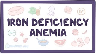 Iron deficiency anemia  an Osmosis Preview [upl. by Ahsemac]