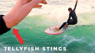 WE SURF JELLYFISHINFESTED REEF WITH SKEET INJURY WARNING [upl. by Hafital]